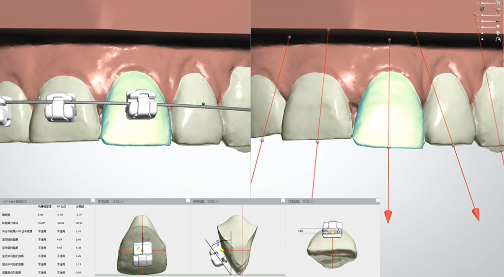 digital treatment in orthodontics