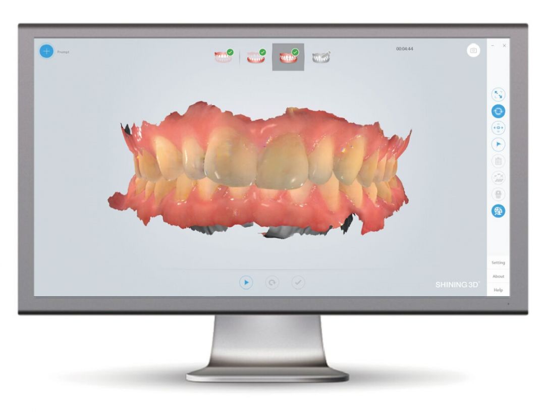 dental cad cam technology