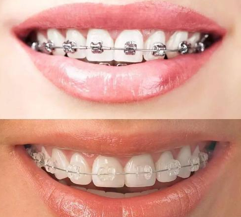 hazards of orthodontics